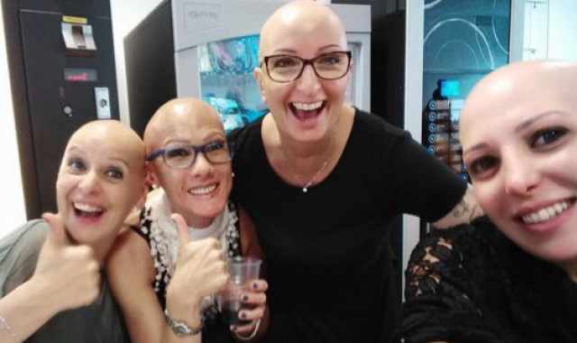 Quando si diventa calvi all'improvviso: E' l'alopecia areata, male non riconosciuto